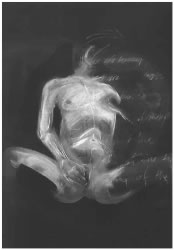 Thomas Gallant - Prints: Skin